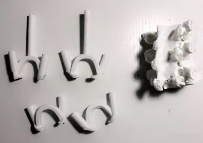 3D Printed Surgical Guide for Medical Application 3D Printed Surgical Guide for Medical Application