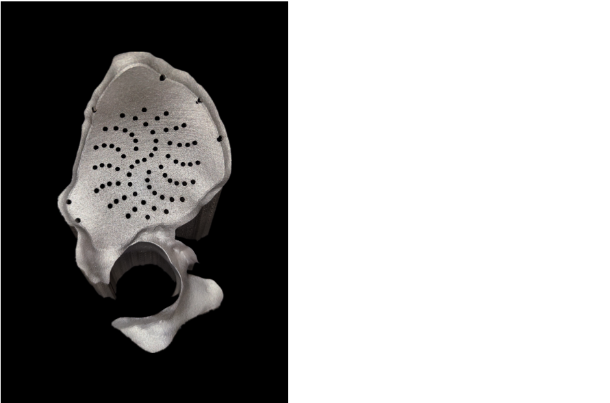 3D Printing in Medical Applications 3D Printing in Medical Applications
