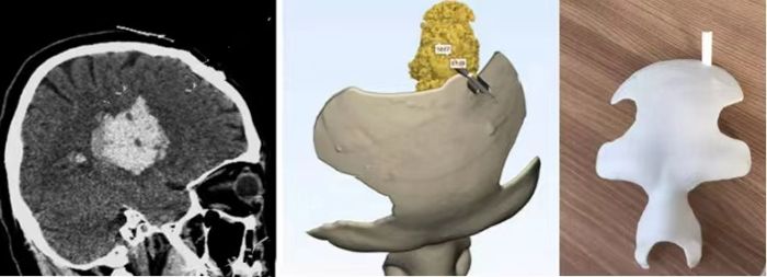additive-manufacturing-solutions-for-medical-industry-1.jpg additive-manufacturing-solutions-for-medical-industry-1.jpg