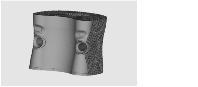 Direct 3D Printed Titanium Alloy Spinal Implants Direct 3D Printed Titanium Alloy Spinal Implants
