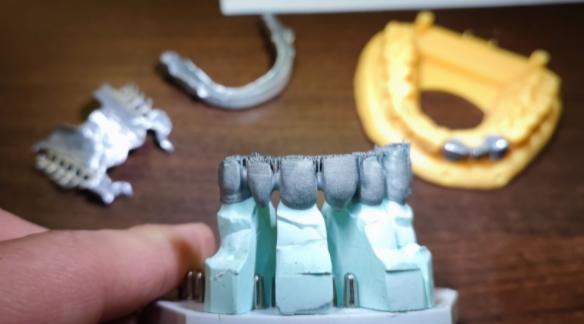 How to choose the Right Dental 3D Printer How to choose the Right Dental 3D Printer