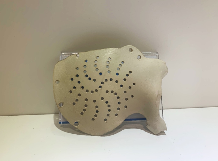 Manufacturing and Materials of 3D Printed Cranial Plates Manufacturing and Materials of 3D Printed Cranial Plates