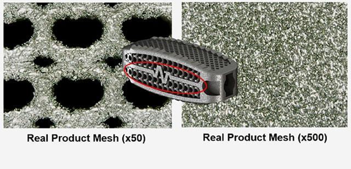 Spinal Implant Manufacturing Using EP-M250 Metal 3D Printer Spinal Implant Manufacturing Using EP-M250 Metal 3D Printer