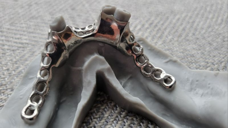 Advantages of Metal 3D Printed Porous Titanium Dental Implants Advantages of Metal 3D Printed Porous Titanium Dental Implants
