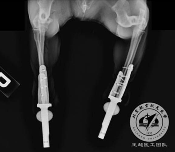 What Metal Material is More Suitable for Implants Printing? What Metal Material is More Suitable for Implants Printing?