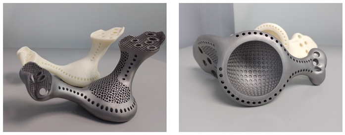 eplus3d-metal-3d-printing-drives-35-market-share-growth-in-implant-manufacturer-02.jpg