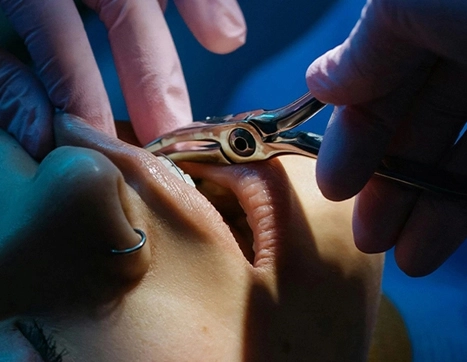 /application-of-3d-printing-in-healthcare/